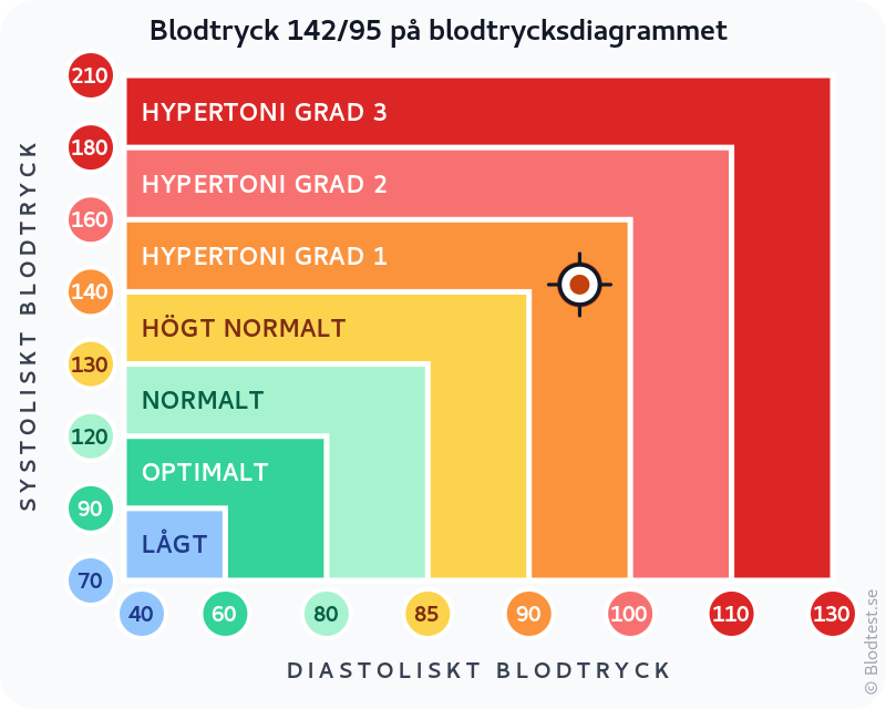 Blodtryck 142 över 95 – hypertoni grad 1 (mild) – klassificeringsdiagram med systoliskt och diastoliskt värde