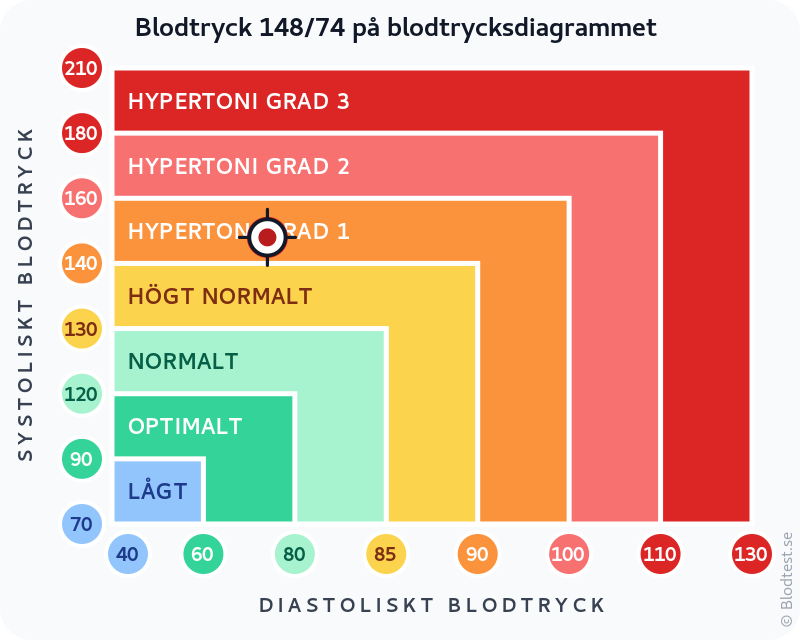 Blodtryck 148 över 74 – isolerad systolisk hypertoni – klassificeringsdiagram med systoliskt och diastoliskt värde