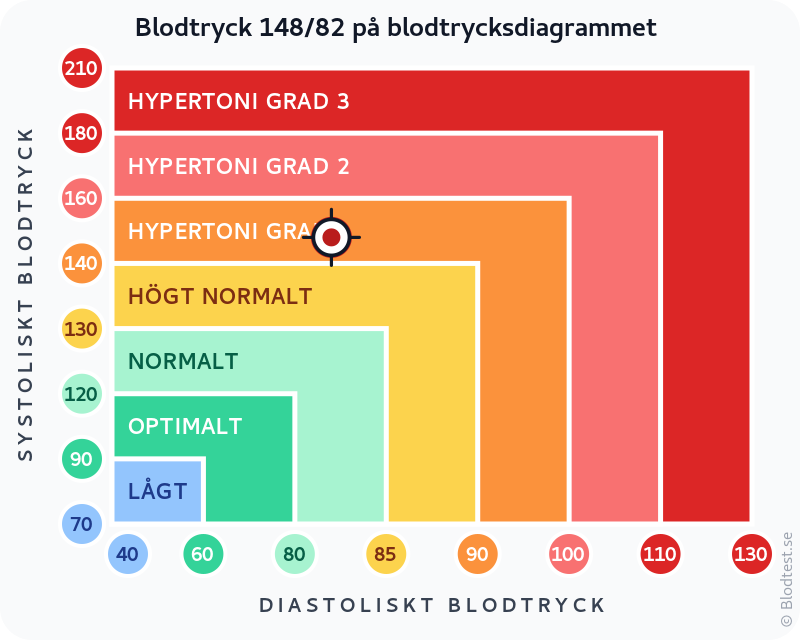 Blodtryck 148 över 82 – isolerad systolisk hypertoni – klassificeringsdiagram med systoliskt och diastoliskt värde