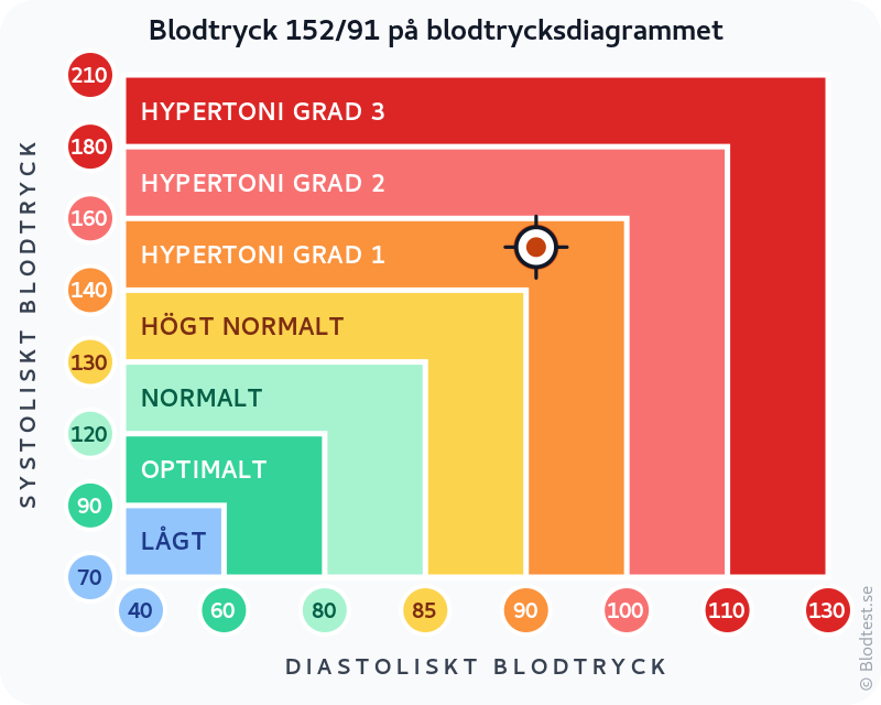 Blodtryck 152 över 91 – hypertoni grad 1 (mild) – klassificeringsdiagram med systoliskt och diastoliskt värde