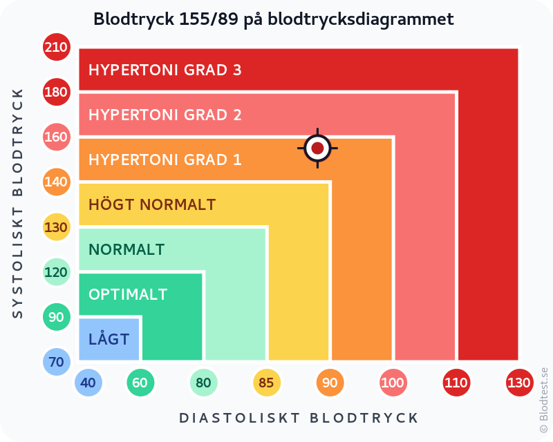 Blodtryck 155 över 89 – isolerad systolisk hypertoni – klassificeringsdiagram med systoliskt och diastoliskt värde