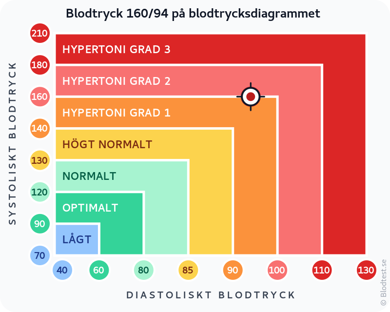 Blodtryck 160 över 94 – hypertoni grad 2 (måttlig) – klassificeringsdiagram med systoliskt och diastoliskt värde