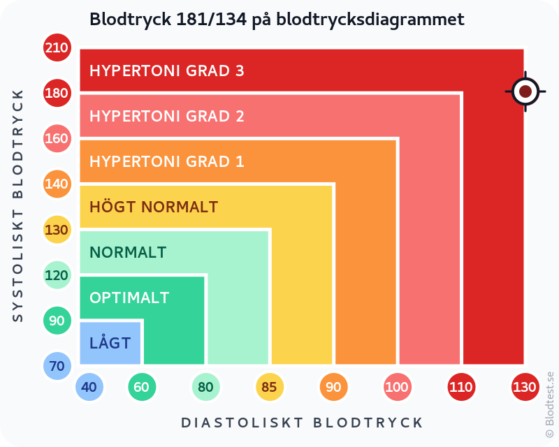 Blodtryck 181 över 134 – hypertensiv kris – klassificeringsdiagram med systoliskt och diastoliskt värde