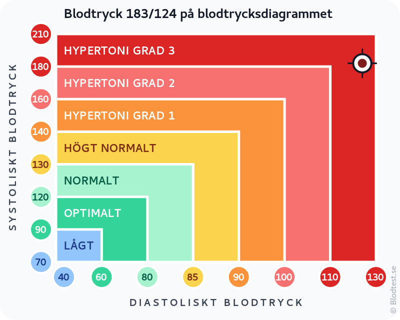 Blodtryck 183 över 124 – hypertensiv kris – klassificeringsdiagram med systoliskt och diastoliskt värde