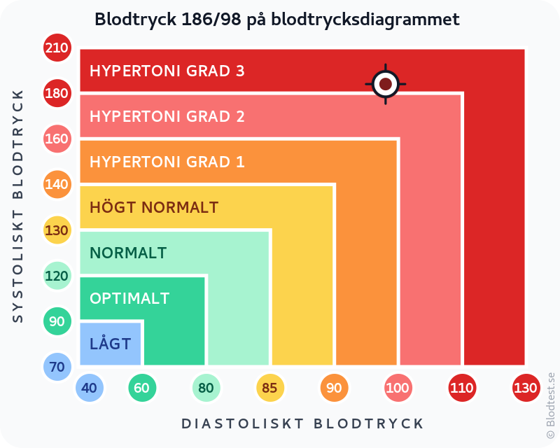 Blodtryck 186 över 98 – hypertensiv kris – klassificeringsdiagram med systoliskt och diastoliskt värde