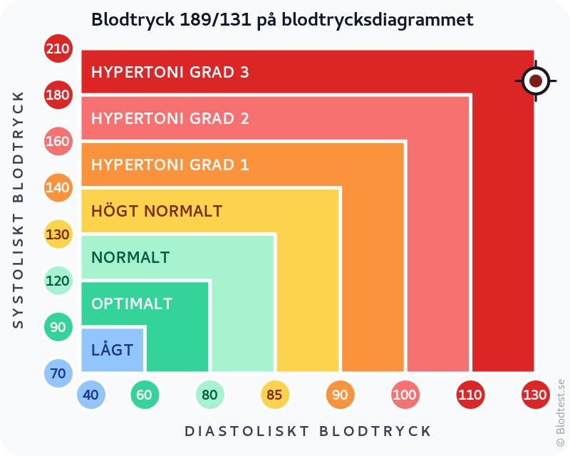 Blodtryck 189 över 131 – hypertensiv kris – klassificeringsdiagram med systoliskt och diastoliskt värde