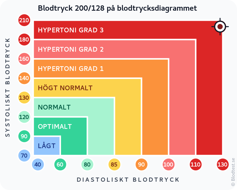 Blodtryck 200 över 128 – hypertensiv kris – klassificeringsdiagram med systoliskt och diastoliskt värde