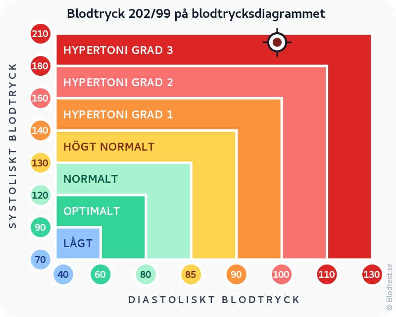 Blodtryck 202 över 99 – hypertensiv kris – klassificeringsdiagram med systoliskt och diastoliskt värde