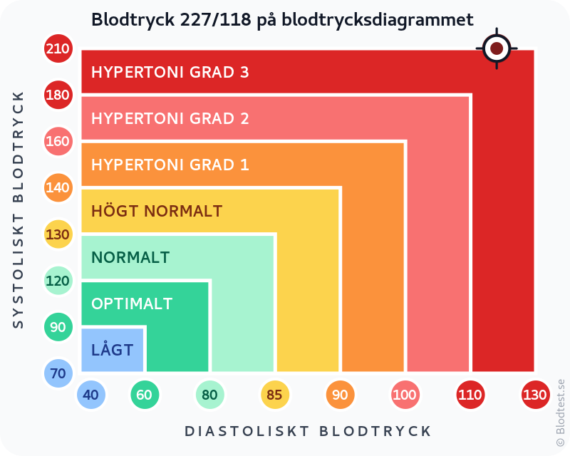 Blodtryck 227 över 118 – hypertensiv kris – klassificeringsdiagram med systoliskt och diastoliskt värde