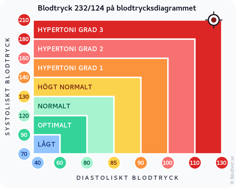 Blodtryck 232 över 124 – hypertensiv kris – klassificeringsdiagram med systoliskt och diastoliskt värde