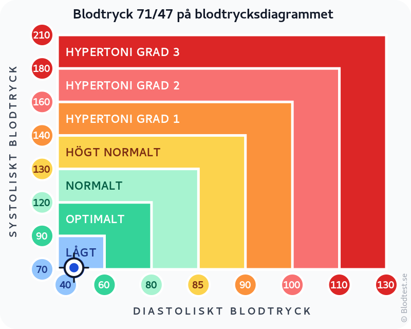 Blodtryck 71 över 47 – lågt blodtryck (hypotoni) – klassificeringsdiagram med systoliskt och diastoliskt värde